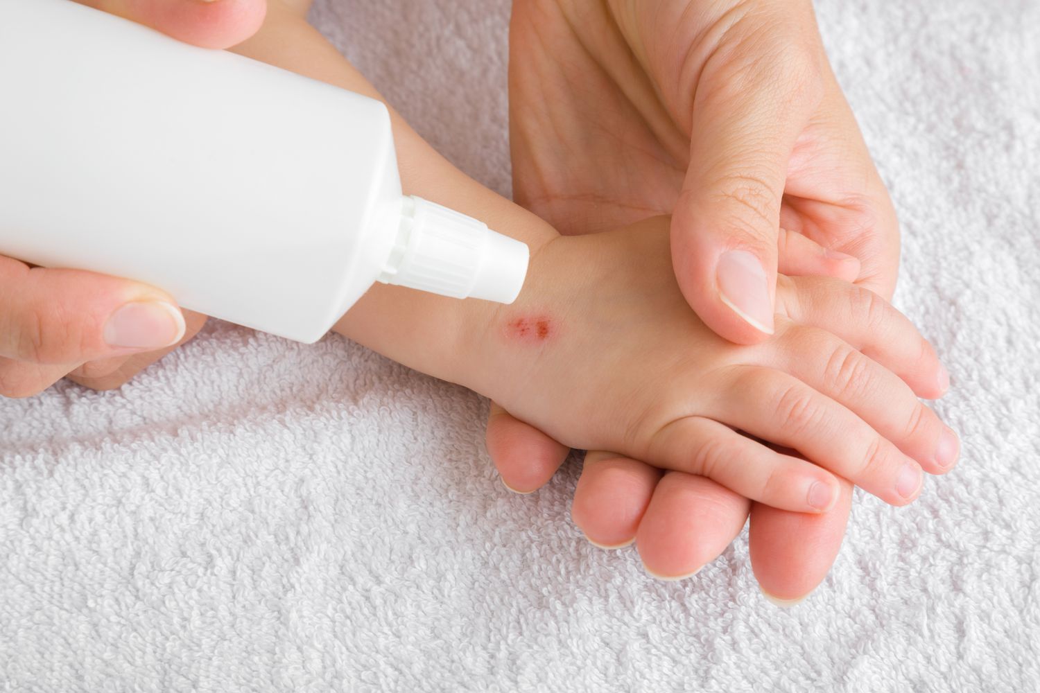Skin Antiseptics